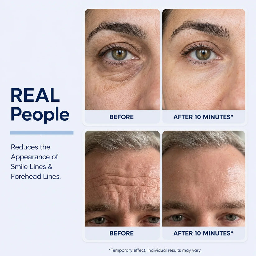 Before and after results