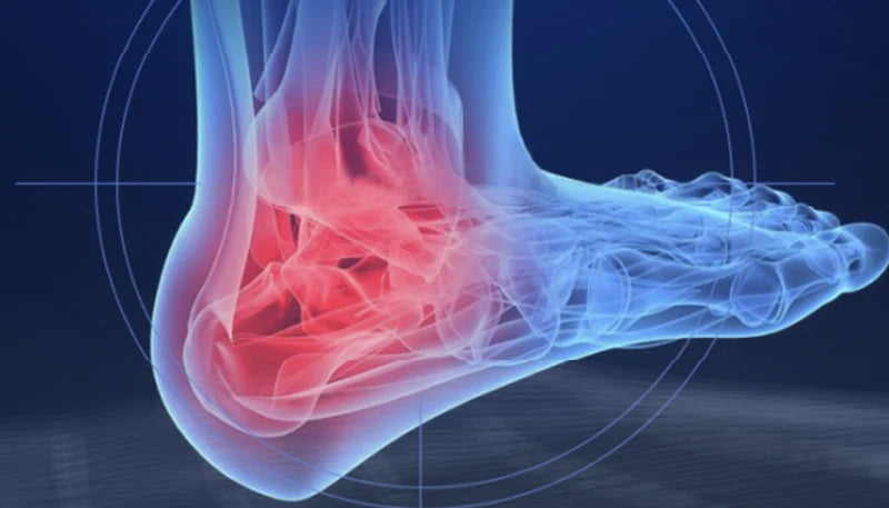 Fascia Spasm